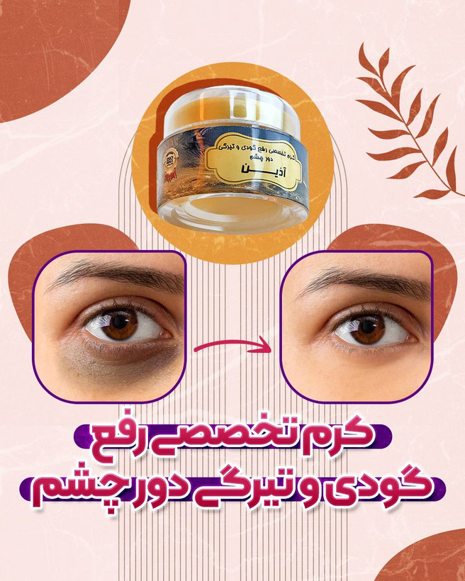 کرم رفع گودی و تیرگی و مراقبت دور چشم اذین