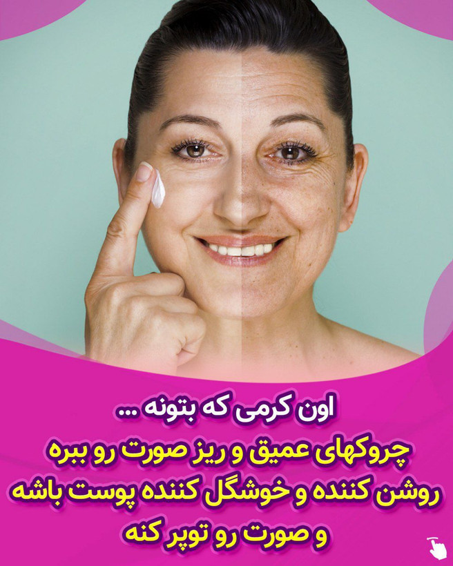 پک سیب سرخ اذین