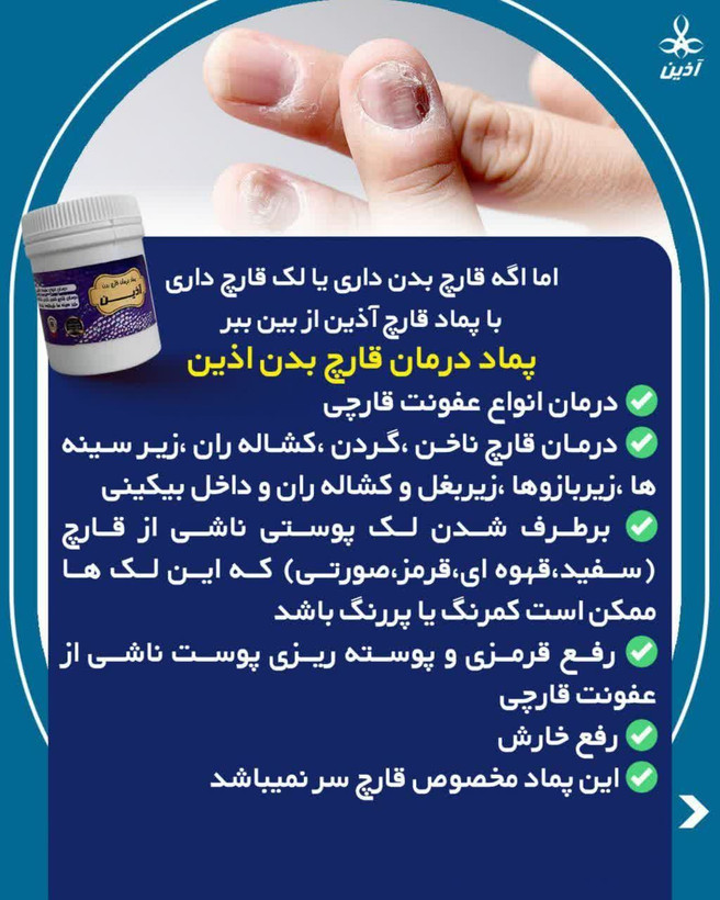 پماد درمان قارچ اذین