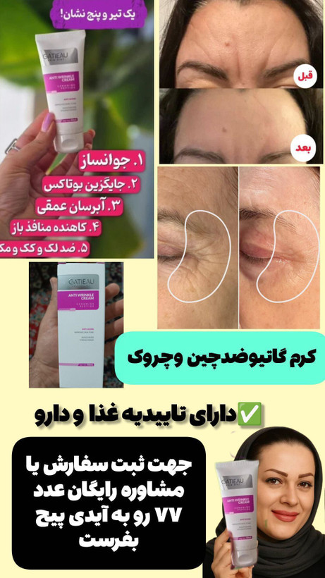 کرم ۵کاره و ضد چین و چروک گاتیو اصل