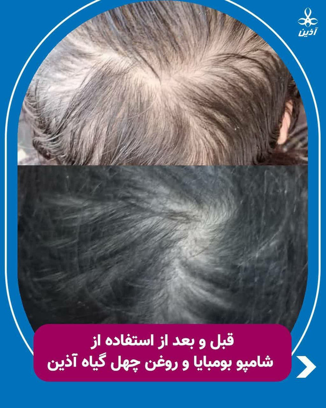پک بومبایا شامل شامپو فوق قوی و روغن چهل گیاه اذین